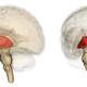 Imagen para el artículo titulado Los monos anestesiados se despiertan al instante cuando los investigadores estimulan la región cerebral vinculada a la conciencia